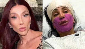 Imagem ilustrativa da imagem Maya Massafera relata dor intensa após procedimento para afinar o rosto