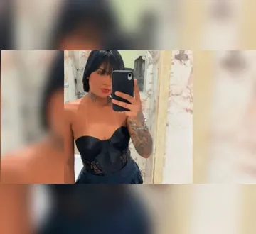 Imagem ilustrativa da imagem Mulher arrastada por ex é submetida à&nbsp;3ª cirurgia e colostomia