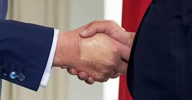 Imagem ilustrativa da notícia Trump reaparece com mão maquiada após diagnóstico de doença