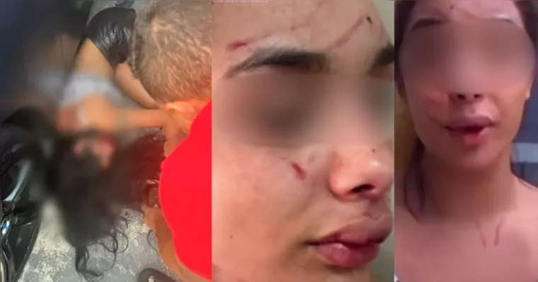 Imagem ilustrativa da notícia Mulher denuncia agressão de Gato Preto após encostar em carro