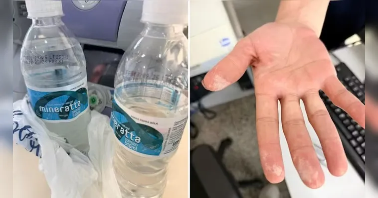 Imagem ilustrativa da notícia Intoxicação por água mineral: saiba como identificar e outros cuidados