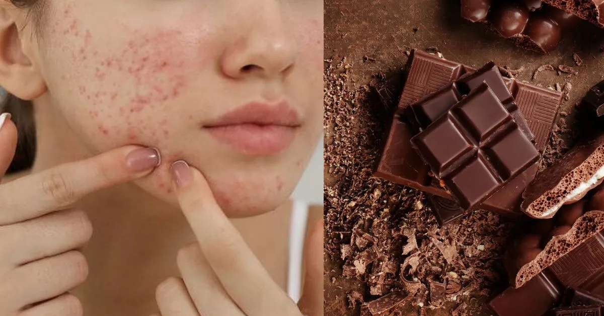 Efeitos do Chocolate na Pele Durante a Páscoa