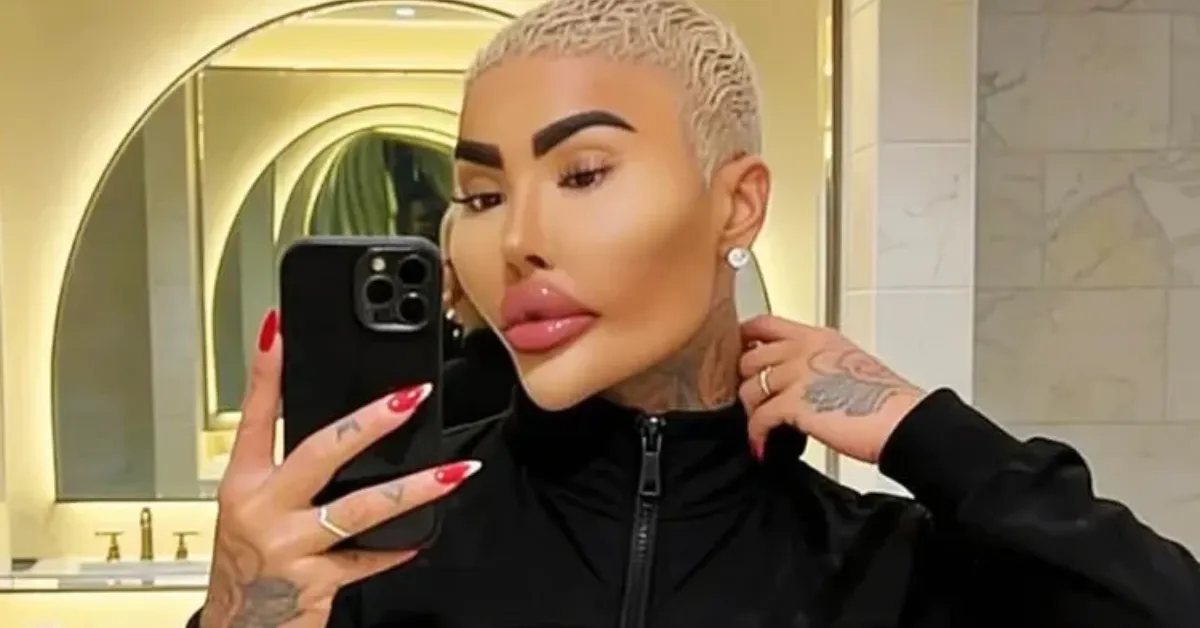 Jordan James Parke, o “Rei dos Lábios”, foi encontrado morto em apartamento de luxo em Londres; polícia investiga as circunstâncias do caso.