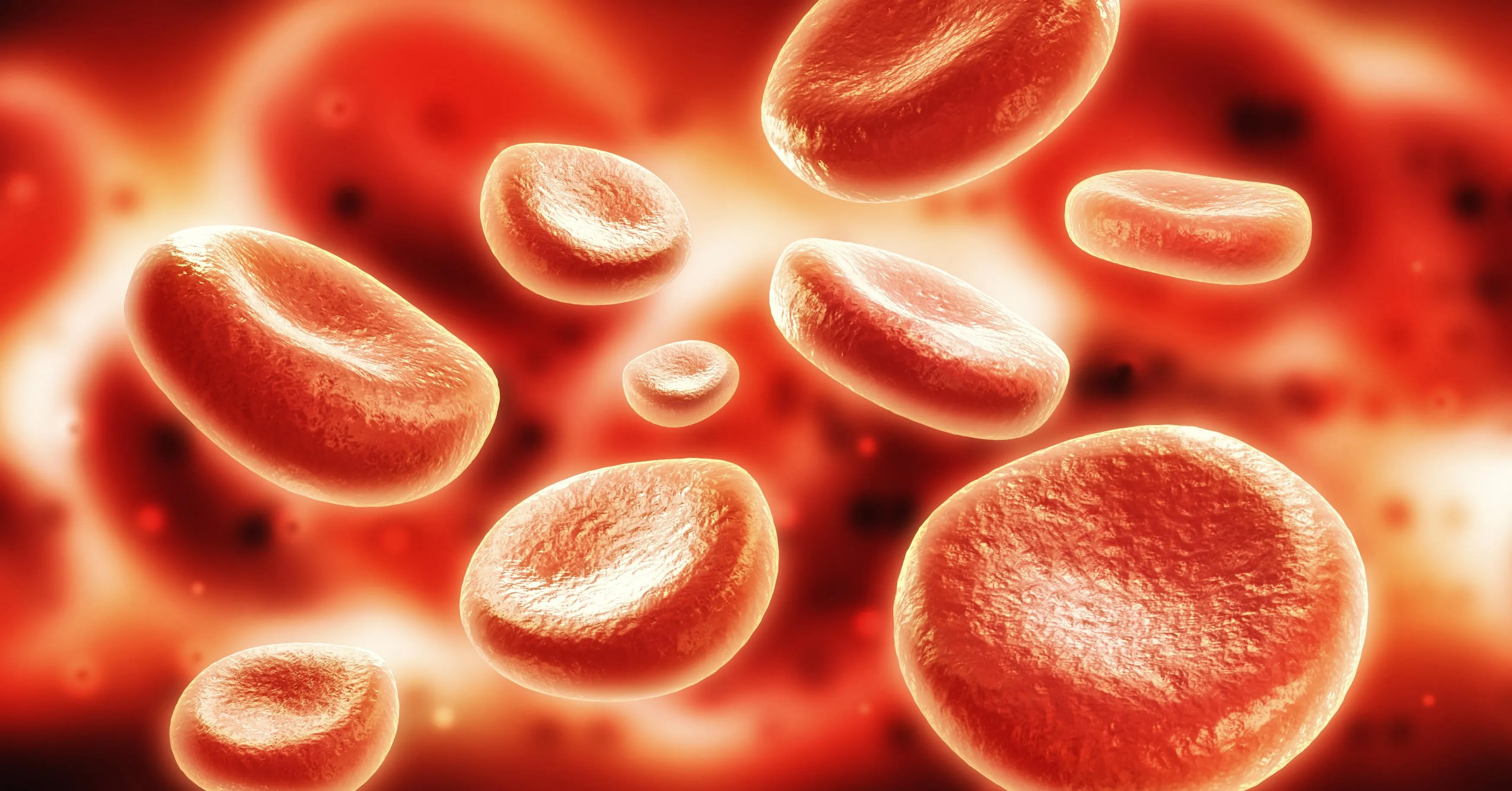 A doença se caracteriza pela multiplicação desordenada das células brancas, que substituem as células saudáveis do sangue.