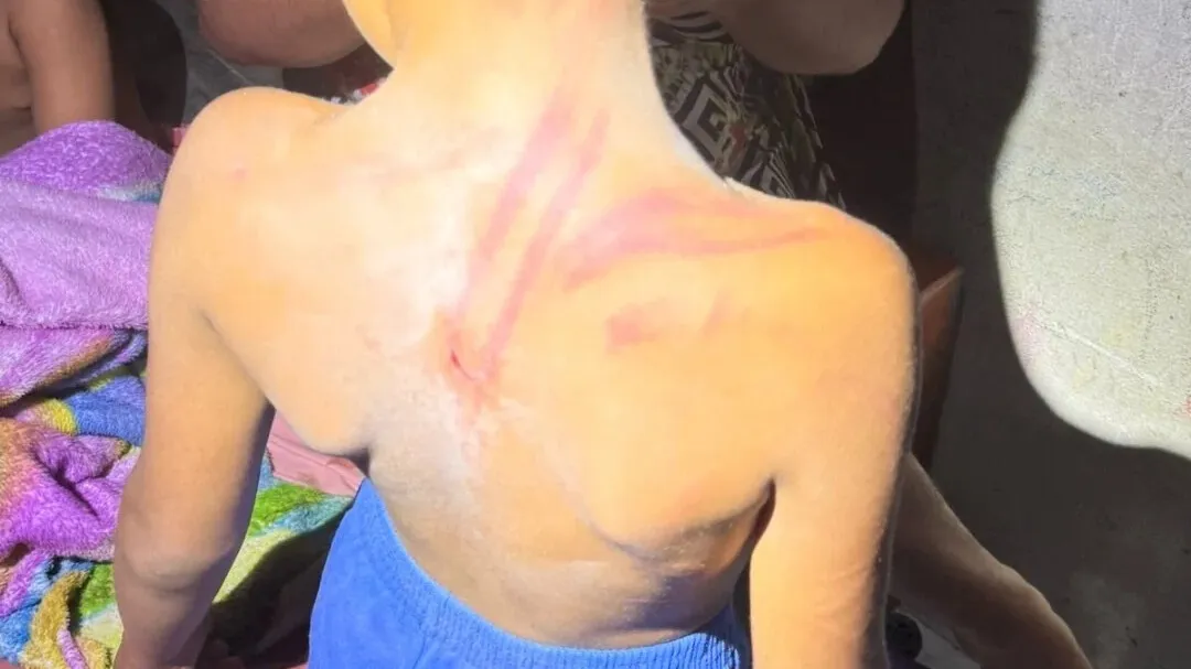 Crianças agredidas com fio elétrico têm 1, 4 e 6 anos, segundo informações colhidas pela Guarda Municipal de Marituba.