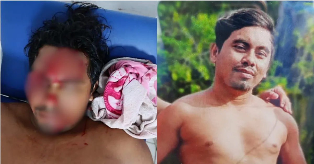 A vítima utilizava uma serra elétrica para cortar um pedaço de madeira com o objetivo de fazer ajustes em sua embarcação