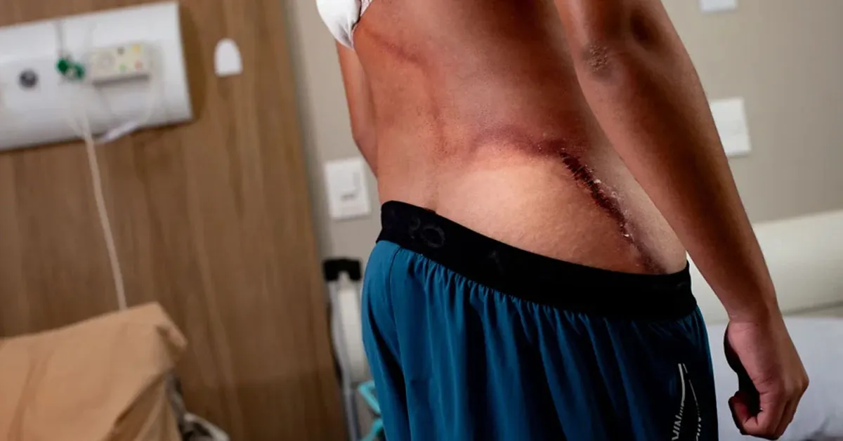 Segundo a mãe, após o choque, o adolescente perdeu a consciência e apresentou braços e pernas arroxeados, além de ficar com o rosto muito pálido.