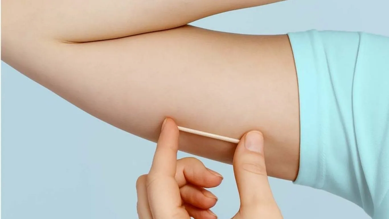 Estratégia coordenada pela Sespa amplia acesso ao método de longa duração na rede pública