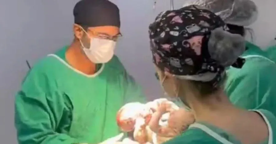 Saiba mais sobre o caso e os próximos passos do tratamento dos siameses