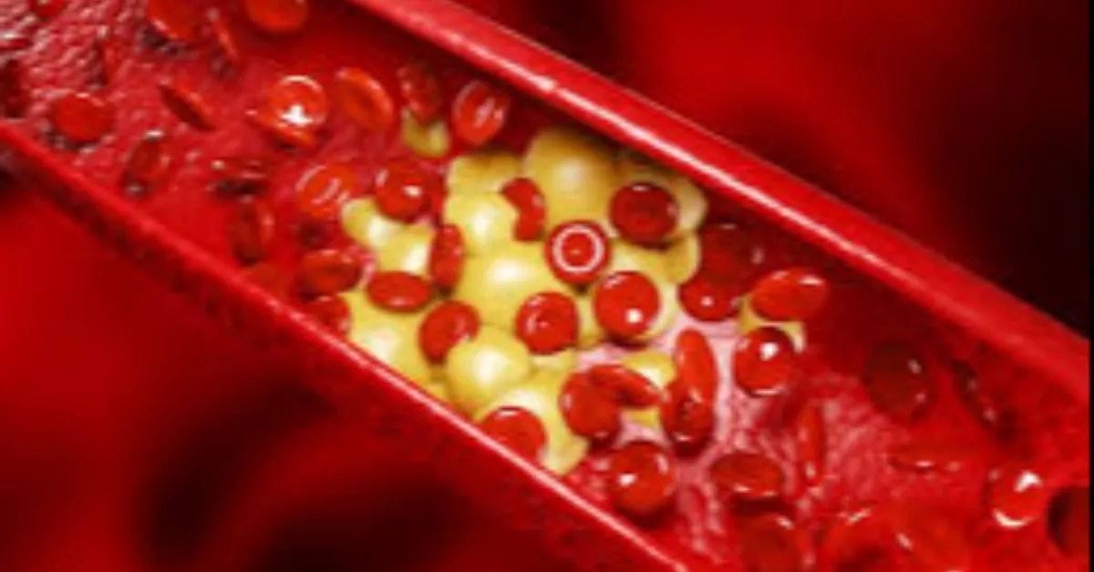 Imagem ilustrativa da notícia: A sua pele pode mostrar sinais de colesterol alto: veja quais