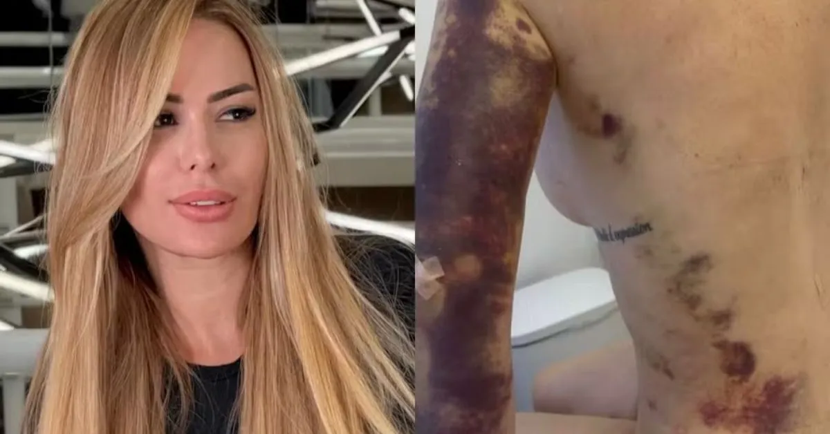 Apesar de todo o investimento em mudanças físicas, Ju afirma que continuava insatisfeita com a própria aparência.