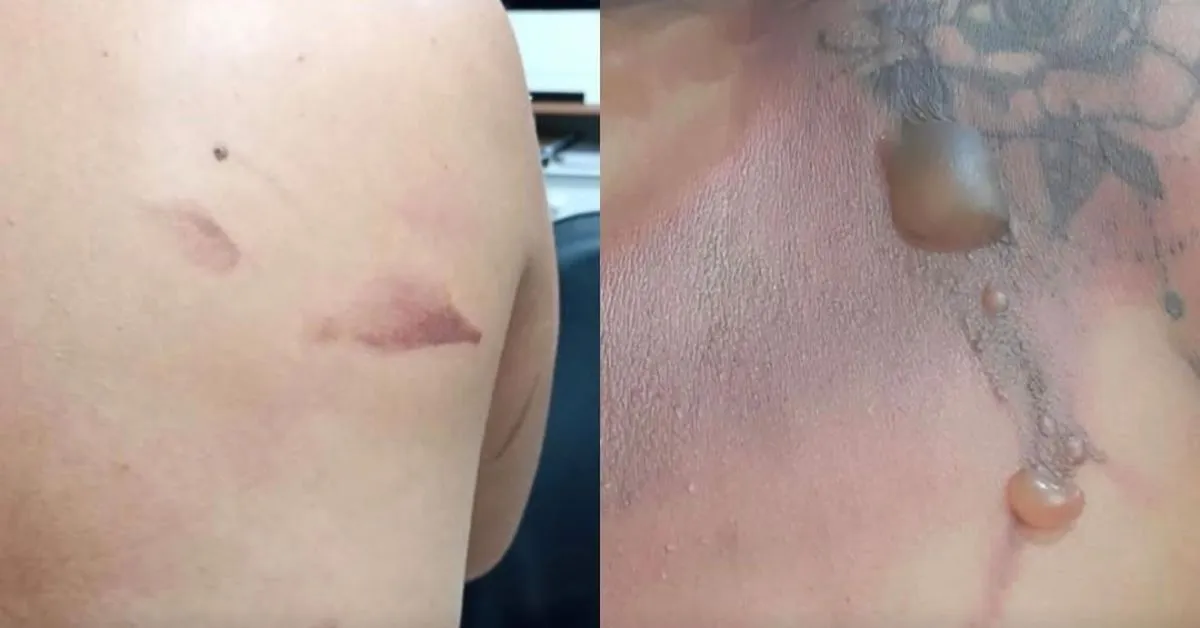 Vítima relatou que já havia sido alvo de outras violências em situações anteriores.