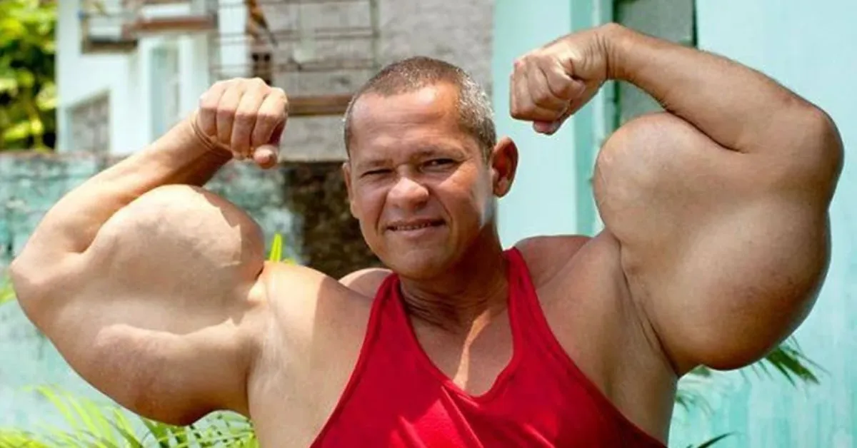 O morador de Águas Compridas ganhou notoriedade ao aparecer em programas de televisão de grande audiência. Ele participou do Programa do Silvio Santos, do Hoje em Dia e do Super Pop, apresentado por Luciana Gimenez.