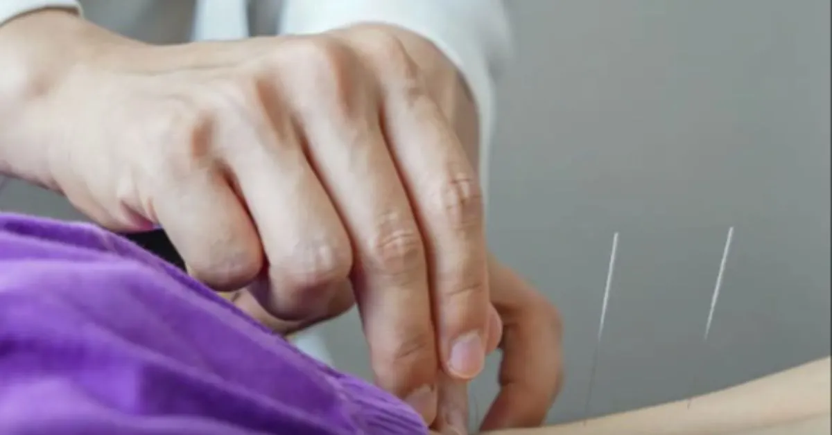 Regulamentação valoriza profissão de acupunturista