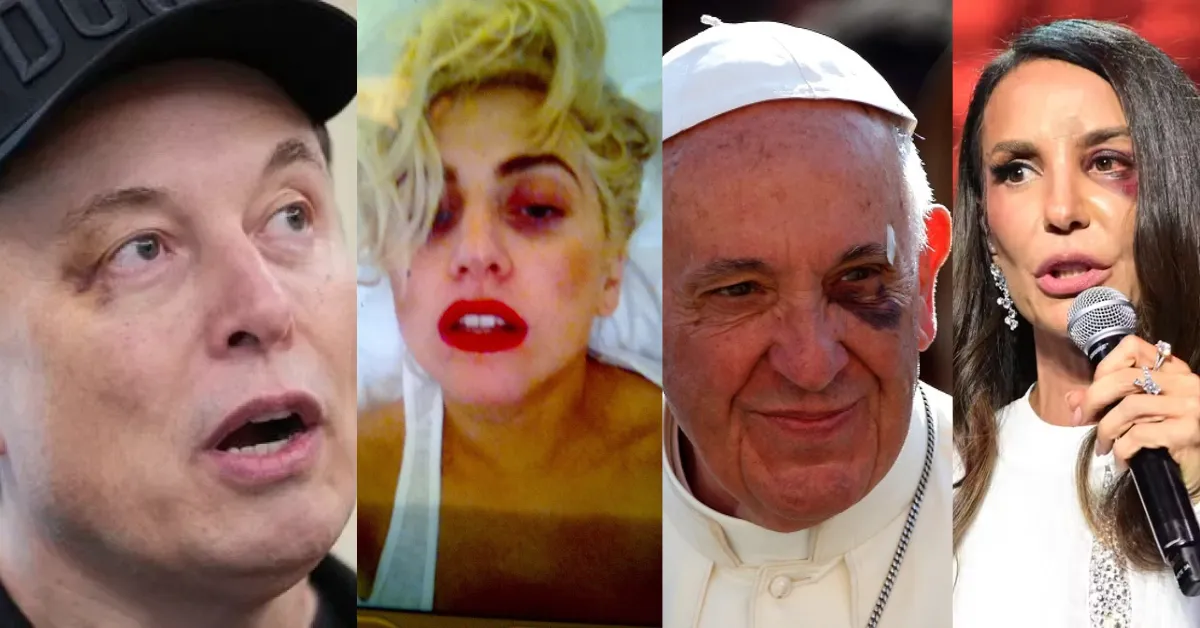 Ivete Sangalo reapareceu em live após cirurgia e tranquilizou fãs sobre recuperação, enquanto teorias conspiratórias sobre o “Olho Roxo” voltaram a circular nas redes.