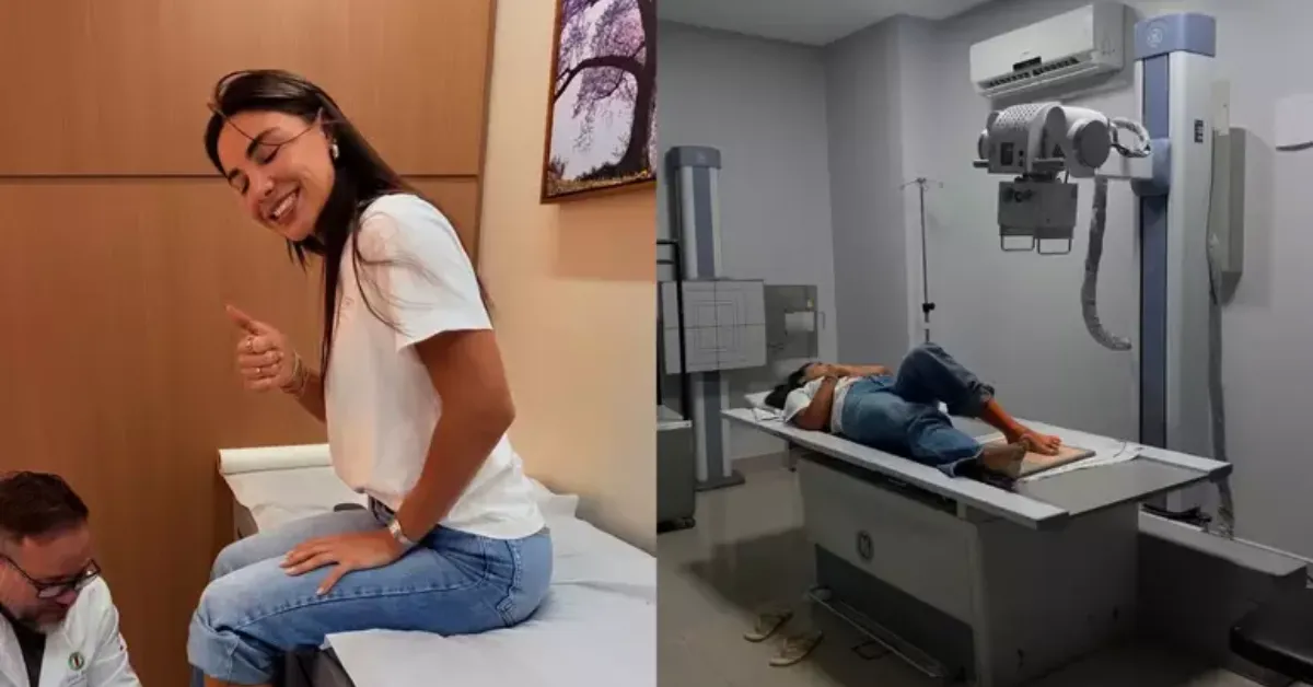 Gabriela Versiani mostra raio-X após fraturar o dedo do pé em acidente doméstico e inicia recuperação com uso de bota ortopédica.