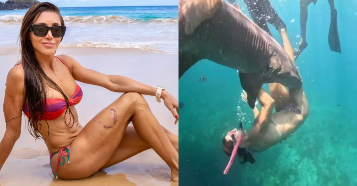 A advogada afirmou que não pretende remover a cicatriz.