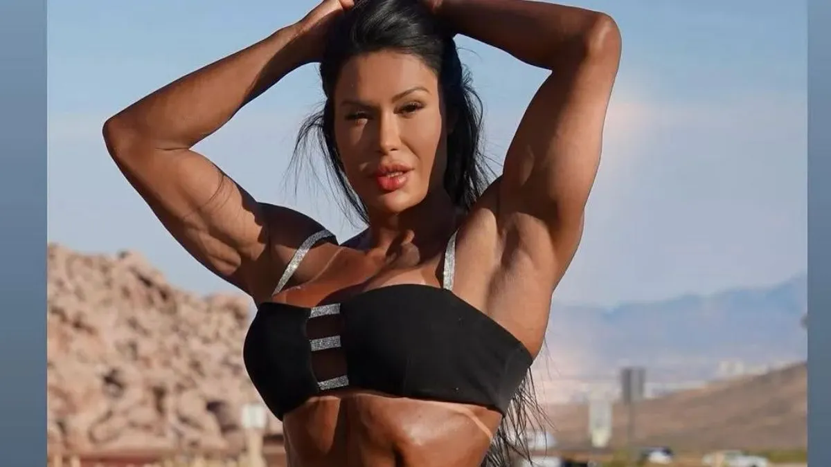 Segundo o profissional responsável pelo procedimento, o objetivo foi criar um visual mais empinado e harmonioso.