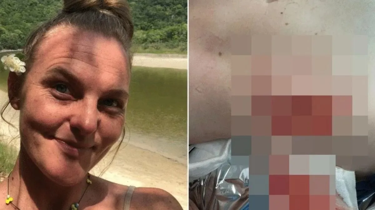 Psicóloga também foi mordida no abdômen e braço.