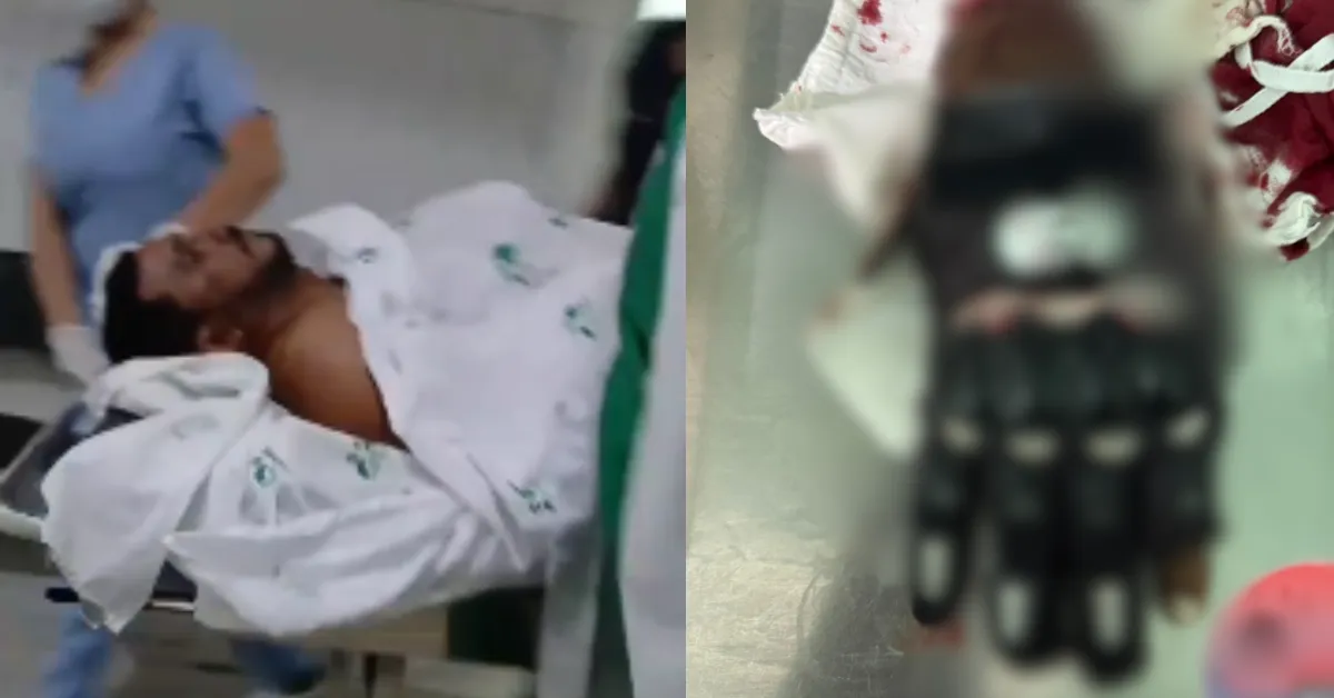 De acordo com informações da Polícia Militar, a vítima foi ferida durante uma briga.