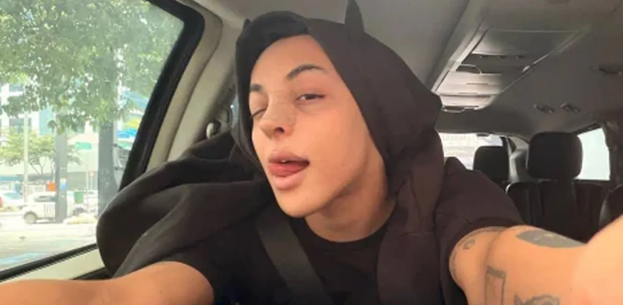 Pabllo Vittar mostra resultado da 3ª rinoplastia.