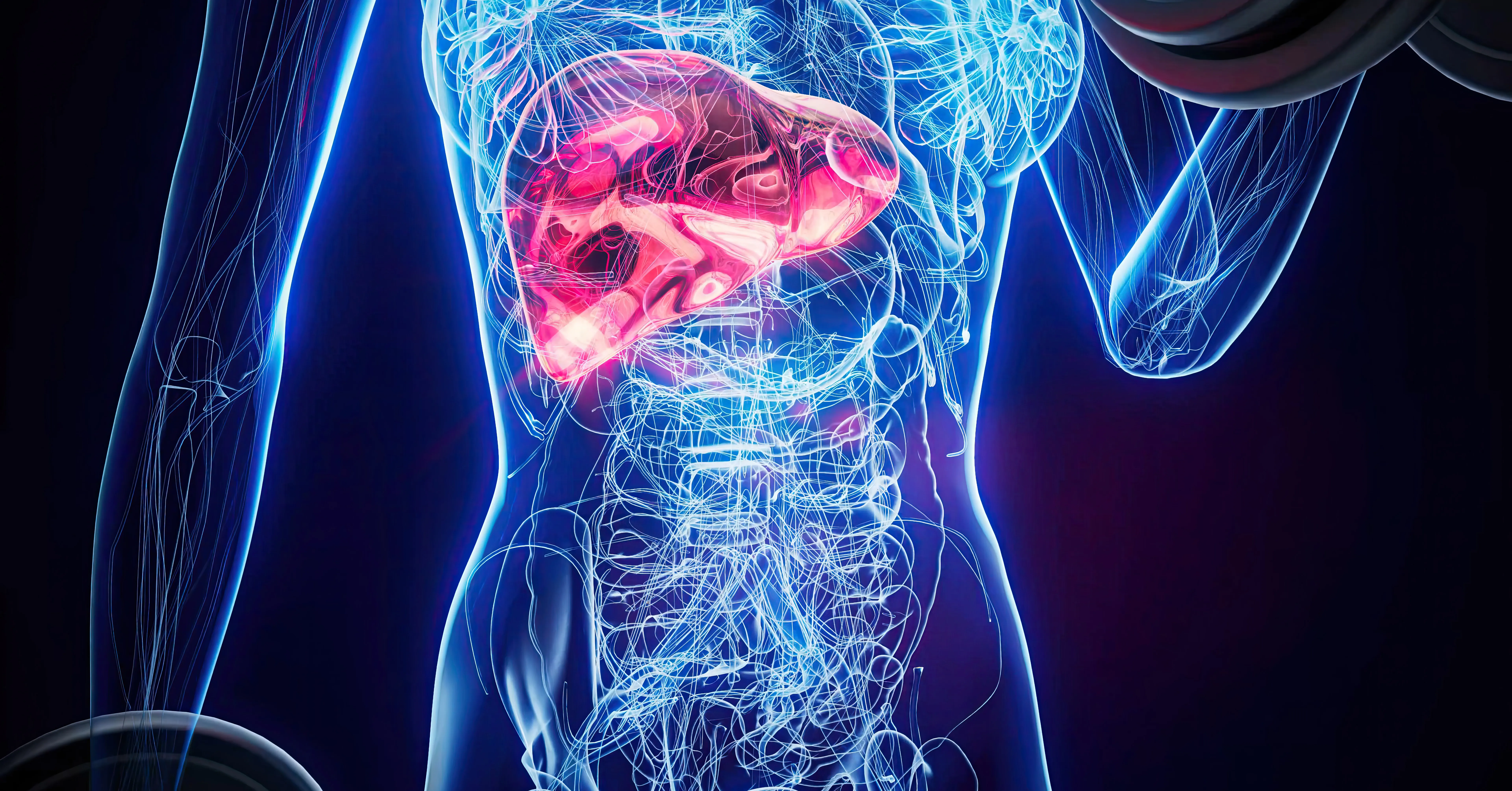 O câncer de pâncreas surge quando células da glândula pancreática passam a se multiplicar de forma descontrolada