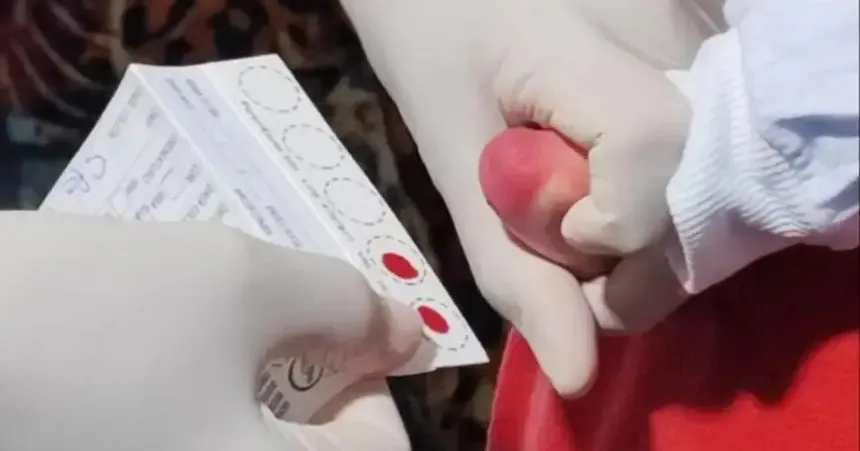 Teste do Pezinho detecta várias doenças, incluindo a toxoplasmose