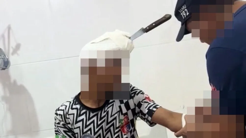 Adolescente de 14 anos ficou com a faca cravada na cabeça.