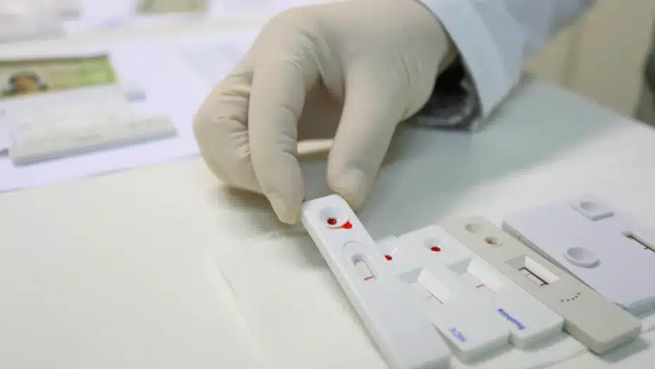 O teste DNA-HPV representa um avanço importante na política de saúde da mulher.