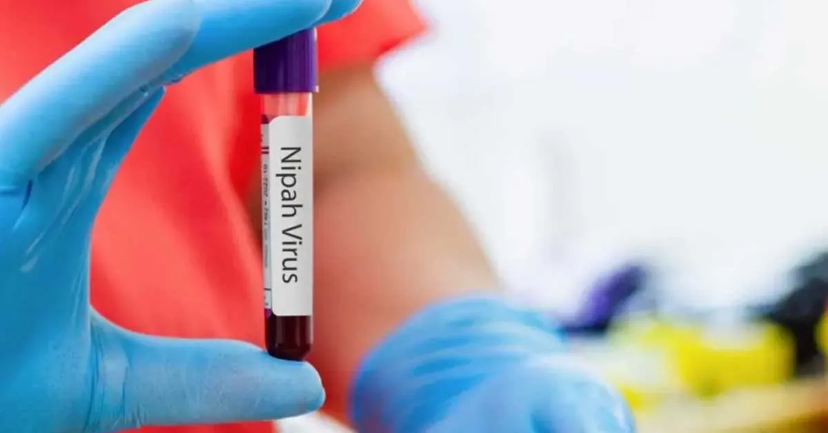 Ministério da Saúde emite alerta sobre o Nipah no Brasil, afirmando que o vírus tem potencial baixo de causar uma nova pandemia.