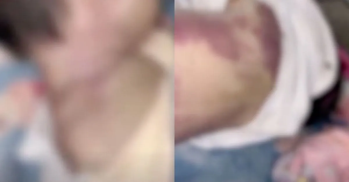 As circunstâncias do caso deverão ser esclarecidas após a conclusão dos exames periciais.