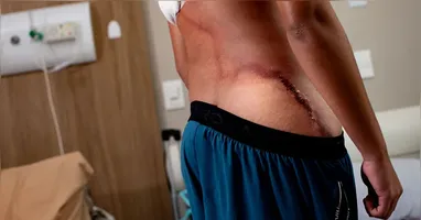 Segundo a mãe, após o choque, o adolescente perdeu a consciência e apresentou braços e pernas arroxeados, além de ficar com o rosto muito pálido.