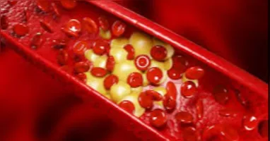 Imagem ilustrativa da notícia A sua pele pode mostrar sinais de colesterol alto: veja quais