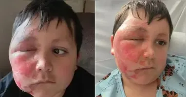 O acidente serve como alerta para que pais reforcem a supervisão sobre o que os filhos consomem nas redes sociais.