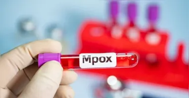 A infecção foi registrada no município de Colatina, no noroeste capixaba.