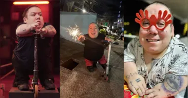 Alejo Little em uma de suas publicações nas redes sociais, onde compartilhava sua rotina e os desafios de viver com displasia esquelética.