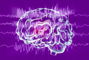 Imagem ilustrativa da notícia Dia de Conscientização sobre Epilepsia: a doença e como combater preconceito