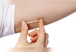 O que é vendido como uma solução rápida para a estética e o bem-estar pode esconder perigos irreversíveis para o cérebro