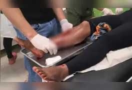 Perna direita da vítima após ser atingida por disparo de arma de fogo na noite de sábado (13), em Tucumã, no sul do Pará.