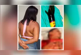 Ciúme excessivo teria sido a motivação da ação violenta da mulher contra o  ex-companheiro