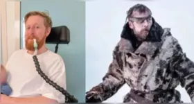 Michael Patrick em cena de Game of Thrones; ator faleceu aos 35 anos após lutar contra doença degenerativa.