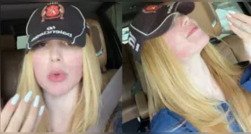 Virginia Fonseca apareceu nas redes sociais com o rosto visivelmente sensível após procedimento estético.