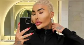 Jordan James Parke, o “Rei dos Lábios”, foi encontrado morto em apartamento de luxo em Londres; polícia investiga as circunstâncias do caso.