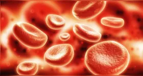 A doença se caracteriza pela multiplicação desordenada das células brancas, que substituem as células saudáveis do sangue.