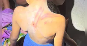 Crianças agredidas com fio elétrico têm 1, 4 e 6 anos, segundo informações colhidas pela Guarda Municipal de Marituba.