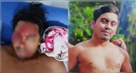 A vítima utilizava uma serra elétrica para cortar um pedaço de madeira com o objetivo de fazer ajustes em sua embarcação