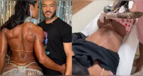 A divulgação gerou repercussão entre seguidores, que comentaram o início do procedimento e associaram a decisão ao encerramento definitivo do relacionamento.