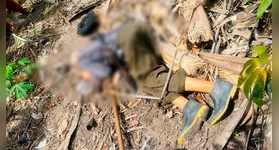 José Nunes da Silva levou um tiro na cabeça de espingarda calibre 20