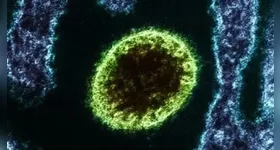 Vírus da doença está distante do Brasil