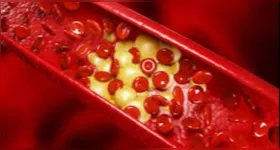 Imagem ilustrativa da notícia A sua pele pode mostrar sinais de colesterol alto: veja quais